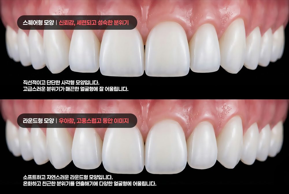세라미스트의 컬러링
